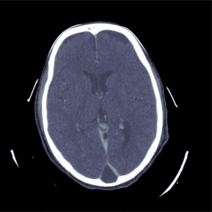 Example slice from a CT scan