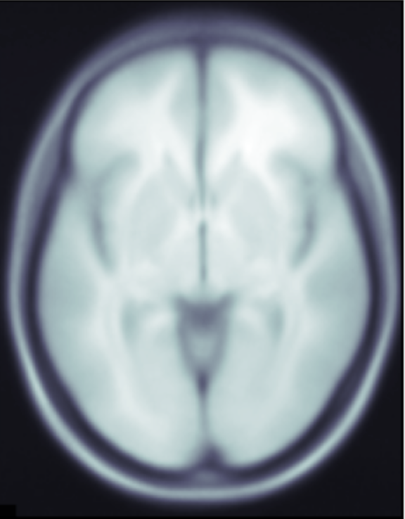 Example slice from an MRI scan